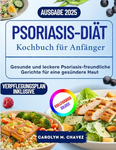 Psoriasis-Diät-Kochbuch für Anfänger: Gesunde und leckere Psoriasis-freundliche Gerichte für eine gesündere Haut