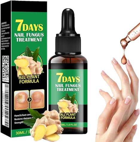 Nail Fungus Treatment, 2025 Ginger Nail Fungus Treatment, Toenail Cuticle Care Oil Care, Fungal Nail Treatment, Ginger Nail Growth Serum, 7 Days Nail Fungus Treatment for Toenail (1)