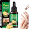 Nail Fungus Treatment, 2025 Ginger Nail Fungus Treatment, Toenail Cuticle Care Oil Care, Fungal Nail Treatment, Ginger Nail Growth Serum, 7 Days Nail Fungus Treatment for Toenail (1)