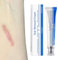 Scar Ointment After, Scar Ointment for Old Scars, Versatile Scar Cream, for Surgical Scars, Caesarean Section, Scars, Burns, Keloids, 30 g