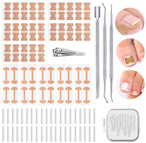 114 Pcs Ingrown Toenail Treatment Corrector, Ingrown Toenail Tool with Nail Clippers Ingrown Toenail File and Lifter, Ingrowing Toenail Treatment Kit, Pedicure Tools for Caring for Toes