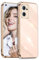 POUHYE Funda para OPPO Find X5 Lite Carcasa Silicona, Protección Cámara Ultra Fina Galvanizado Suave TPU Bumper Resistente Antigolpes Móvil Case para OPPO Find X5 Lite Rosa