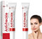 Soleneva 2 Stück Anti Freckle, Gegen Pigmentflecken & Altersflecken, Anti Aging Creme für Frauen, Gesichtscreme Damen zur und Faltenreduzierung, Altersflecken Entfernen Facial Treatment