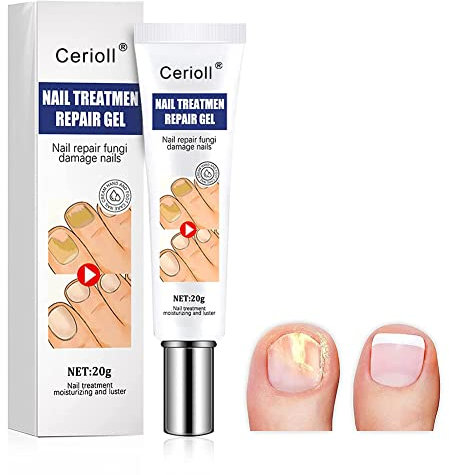 Emollient Ongle, Soins,Pour Des Pieds, Antifongique,Micose Sévère