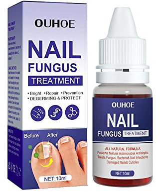 10ml Repair Nail Fungus Treatments Essence Fungal Nail Treatment Care Repair Liquid Finger Toe Nail Fungus