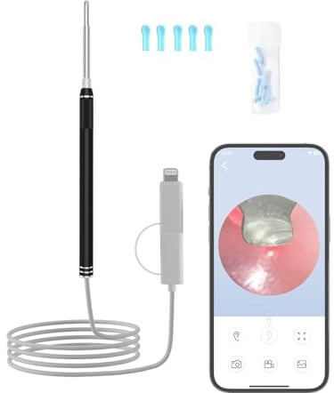 Ohrenschmalz Entferner Otoskop- Drahtloser Ohrreiniger HD-Ohrenschmalz-Entferner mit sichtbarem LED-Otoskop - Tragbarer Ohrenschmalz-Reiniger mit USB 2 in 1 Aufladung für Smart Phones, Android