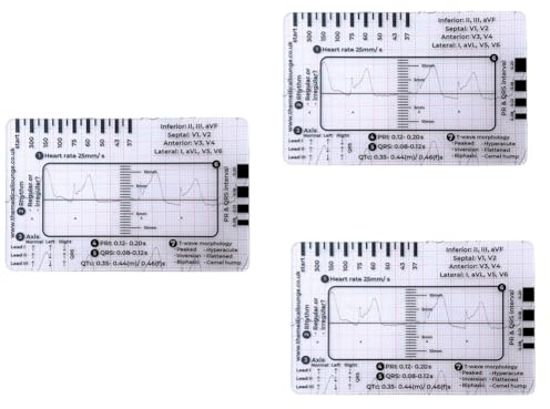Ptdfjspt EKG-Lineal mit 7 Schritten, EKG-Lineal, Kunststoff-Lineal, Messwerkzeug, EKG-Lineal mit 7 Schritten für EKG-/EKG-Interpretation
