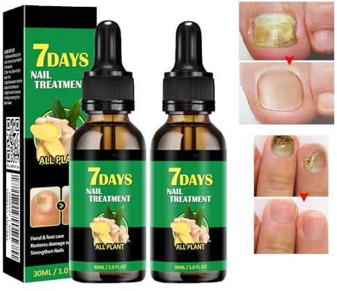 Ginger Nail Treatment Nail Support Nail Care, Ginger Nail Treatment, 7 Days Nail Treatment, Cuticle Serum for Nails, Ginger Nail Growth Serum, Ginger Cuticle Care Oil for Nails (2pcs)