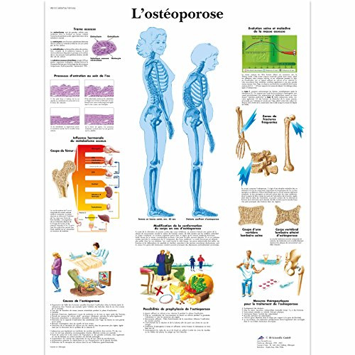 3B Scientific - anatomische Platte