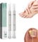 Nail Care Pen & Serum - Nourishing Cuticle Oil & Growth Treatment For Nails & Feet (white2Pcs)