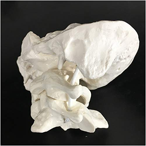 FHUILI Atlas und Axis mit Hinterhauptsbein Modell - Human Hinterhauptsbein Modell - PVC-Material Halswirbel Modell für Medizinische Ausbildung Ausbildungshilfe,A