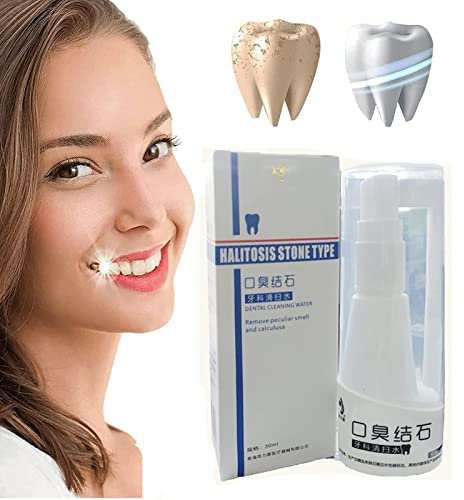 Zahnsteinfrei auflösendes Zahnspray, Munderfrischungsspray, Plaque-Entferner für Zähne, Mundspülung, Zahnpasta zur intensiven Fleckenentfernung 30 ml (1pcs)