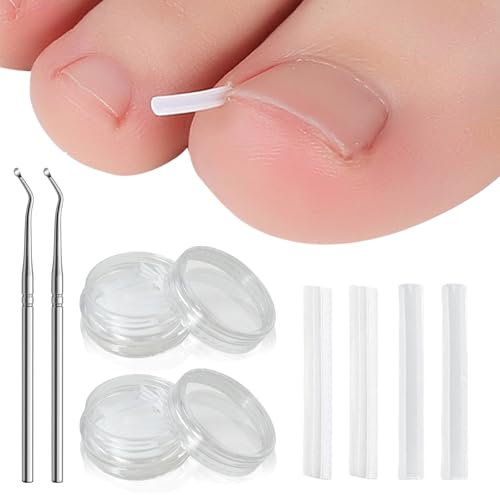 UILYNIU 102 Pièces Ongles Incarnés Pieds Outil, Ensemble d'Outil Ongle Incarné, Ongles Incarnés Pieds Correcteur, Poussoir D'Ongle Incarné, Ongle Incarné kit, Soin des Pieds Outil (Transparent)