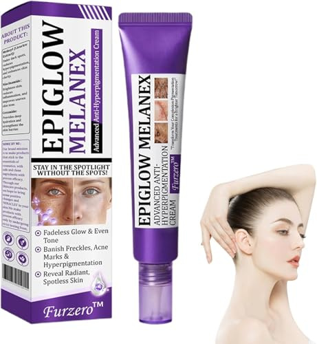 Anti-Hyperpigmentierungscreme, aufhellende Creme zur Entfernung von Pigmentflecken, tiefenreinigende Creme
