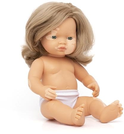 Miniland: Kaukasische dunkelblonde Babypuppe mit Vitiligo, 38cm, handgefertigt in Spanien aus weichem Vinyl Puppen.