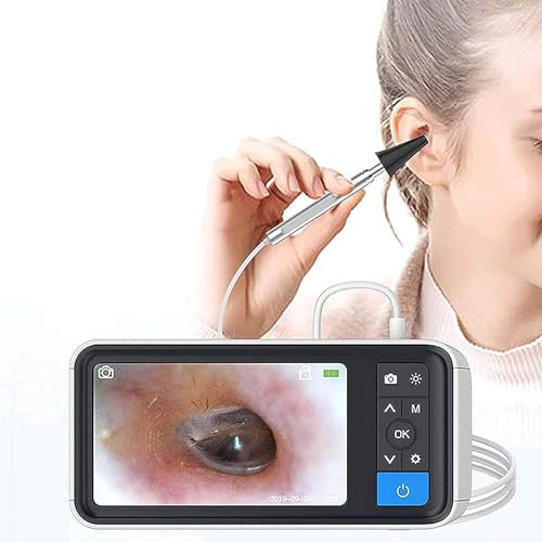Kadxyan Digital Otoscope, 3.9mm Lens, 4.5 Inch Screen, Digital Otoscope With 6 LED Lights, Ear Wax Camera With 2500mAh Rechargeable Battery, For Adults, Children And Pets