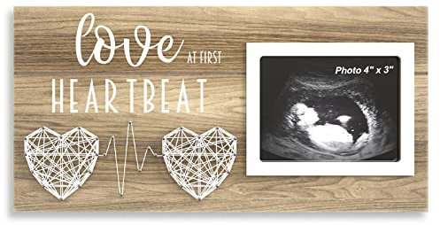 Baby-Scan-Fotorahmen für Standard-Sonogramm-Ultraschallbild, 10,2 x 7,6 cm, Schwangerschaftsankündigungen, Ideen, Gender Reveal Baby-Shower Geschenk – Neue Mutter, die Eltern erwarten, Andenken