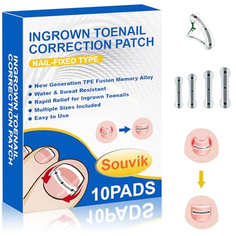 Souvik Eingewachsener Zehennägel Set, Nagelspange Fußnägel Nagelkorrekturspange 10Pcs, Zehennagel Eingewachsen-Heber Nagelpflaster für Männer, Frauen, Zehennägel Korrektur Patch, 17/18/19/20 mm