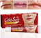 Cold Sore Cream,Cold Sore Treatment,Cold Sore Relief Cream,Mouth Ulcer Treatment for Adults,Natural Formula Coldsore Cream to Reduce Pain,Fast Acting Pain Relief Gel,Mild Cold Sore Cream for Lips