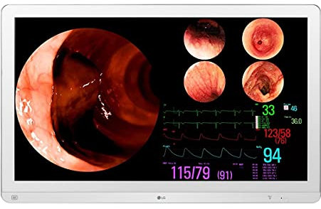 LG Schermo Ultra HD, Bianco, 80 cm
