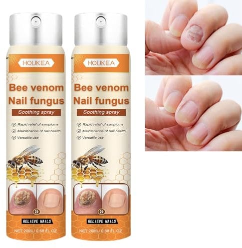 2PCS Bee Venom Nail Fungus Soothing Spray,Nail Fungus Treatment,Bee Venom Nail Treatment Serum,Fungal Toenail Treatment,Natural Bee Venom Nail Serum for Nail Growth,Nail Repair Essence