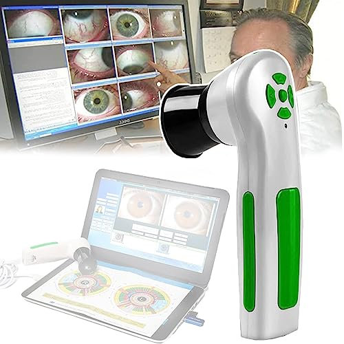 ZILOOK Medizinische Irisspiegelkamera, USB-HD-Irisanalysator, Automatischer/Manueller Fokus, Professionelle Iris-Augendiagnosesoftware, FüR Gesundheitsmanagementzentren,Automatic