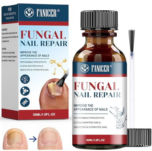30ml Nail Treatment, Fast Extra Strong Nail Repair Solution, Nail Treatment Serum, Repair for Damaged Discolored Thick Nail, Repairs and Renew Damaged, Broken, Cracked & Discolored Nails