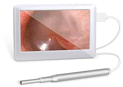 Otoscope Oreille Camera Oreille HD Camera Nettoyant Oreille Portable avec 6 LED et Outil de Nettoyage IP67 Étanche Nettoyant Oreille Portable