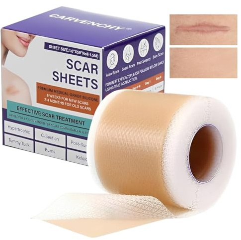 VRYNDH Cerotti Silicone Cicatrici,Silicone scar sheets- 4CM*1,5M Riusabili Mediciali, Per Taglio Cesareo, Cheloidi, Ipoallergenico Traspirante Impermeabile Trasparente