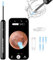 Ohrenschmalz Entferner Otoskop, 1080P Ohrenreiniger mit Kamera, IP67 Wasserdicht Ear Cleaner, 360°-Weitwinkel ohr reinigung kamera, WiFi Ear Wax Removal Camera für iPhone, iPad und Android-Smartphones