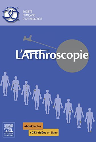 L'arthroscopie (Hors collection) (English Edition)