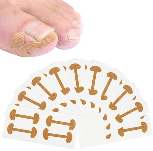 40 Stück Eingewachsene Zehennägel,Zehennagel Korrektur,Eingewachsener Zehennagel,Nagelspange Fußnägel,Nagelspange,Eingewachsene Zehennägel Aufkleber, Für Eingewachsene Zehennägel und Nagelklammern