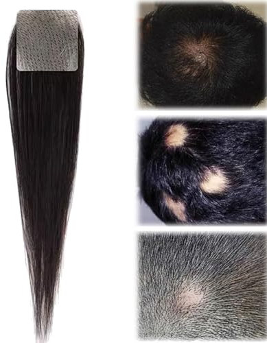 Haarpflaster für den vorderen Haaransatz, vollständige Hautbasis, vertuschende Haarpflaster, Stück Echthaar-Topper für Haarausfall oder dünnes Haar(2.5 * 2.5cm)