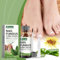 Fungal Nail Treatment, Nail Fungus Treatment For Toenail, Toenail Softener, Fungal Nail Treatment For Toenails Extra Strong Correction Ingrown Toenail Drops