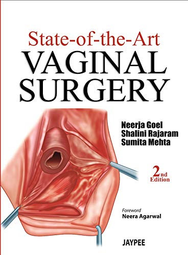 State-of-the-Art: Vaginal Surgery (English Edition)