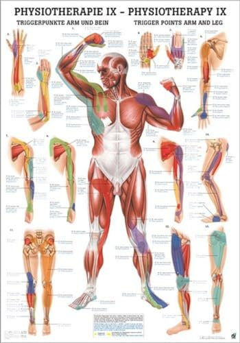 Triggerpunkte I Arm & Bein. 50x70 cm: Trigger Points Arm and Leg
