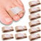 YCZARD 10Pcs Hammer Toe Straightener Hammer Toe Separators Bandage, Broken Toe Wraps Splint Bandages, Hammer Toe Corrector for Correcting Hammer Toes,Broken Toes,Crooked Toes & Overlapping Toes