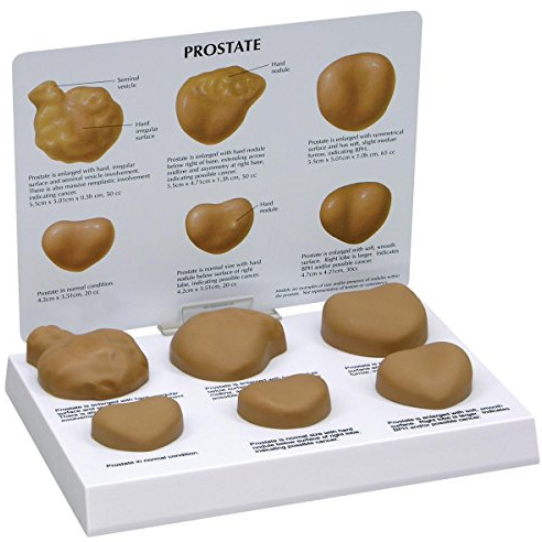 GPI Anatomicals W33366 Prostata Modell