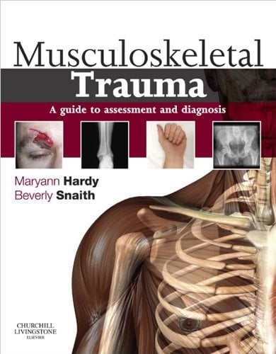 Musculoskeletal Trauma E-Book (English Edition)