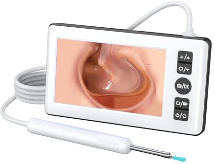 visclyn Earwax Removal Kit with 4.3 IPS Display & 1080P HD Camera | Standalone Ear Cleaner, Intuitive Button Operation, 3H Continuous Working, 9 Silicone Tips, No Phone Required