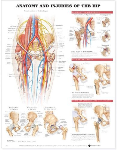 Anatomical Chart Company Anatomy and Injuries of the Hip Anatomical Chart [Parallel Import]