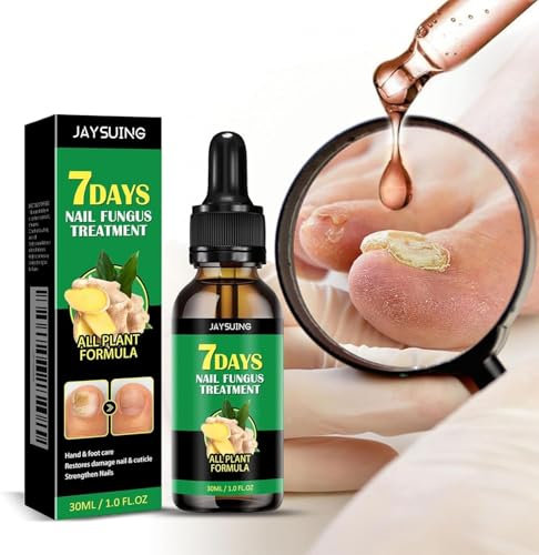 Traitement Ongles,Traitement Des Champignons à Ongles à 7 Jours,Champignon Ongles Traitement, Traitement Ongles, Favorise La Repousse D'ongles Sains