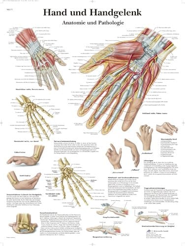 3B Scientific Lehrtafel - Hand und Handgelenk - Anatomie und Pathologie, VR0171UU