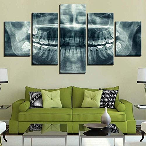 Leinwand 5 Teilig Dental Röntgen Zähne 5 Wandkunst Stück Leinwand Wandbilder Wohnzimmer Moderne Für Schlafzimmer Dekoration Wohnung Home Deko Kunstdruck Mit Rahmen 200 X 100 Cm -0D1D/E0A8-1L6V/E0Y3-3R