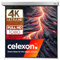 celexon Professional Plus Electric screen 100 | 180x180 cm 1:1 | Electric 4K, Full-HD presentation screen for your home cinema projector | for ceiling/wall mounting | with remote control