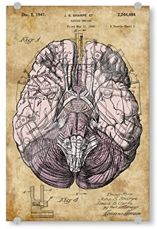 artboxONE Acrylglasbild 150x100 cm Menschen Steampunk Gehirn - Bild anatomie des gehirns anatomie des gehirns gehirn