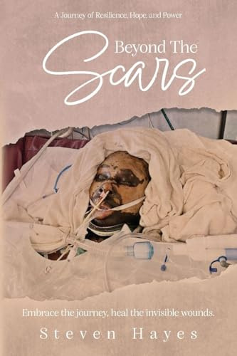 Beyond The Scars: A Journey of Resilience, Hope, and Power