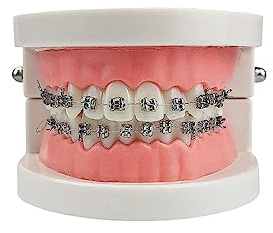 tandard Orthodontic Teeth Model, Dental Demonstration Orthodontic Model Teeth Teach Study Tools with All Mouth Metal Bracket