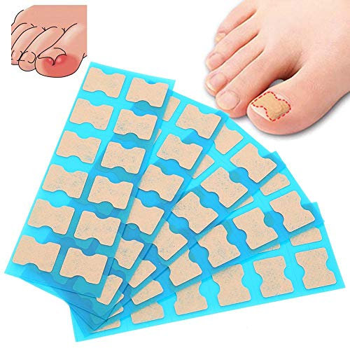 Ingrown Toenail Stick Patch, 4 Sizes Glue-free Toe Nail Correction File Patch Paronychia Corrector Foot Care Treatment Pedicure Tool Ingrown Toenail Correction Patch(2#)