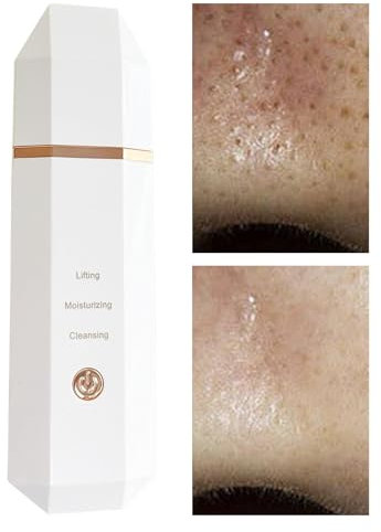 Lmaisdh Spatola esfoliante per il viso, ad ultrasuoni, per la pulizia dei pori, senza fili, ricaricabile, resistente all'acqua, spatola per il contouring
